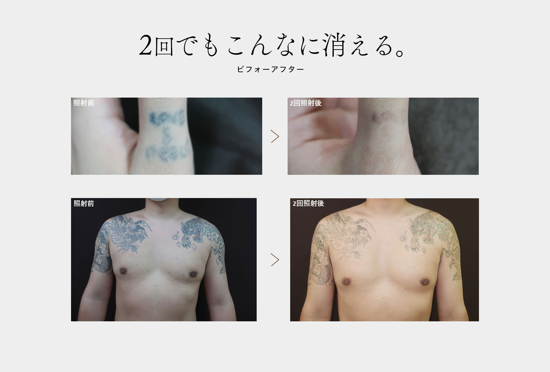 症例紹介 before after