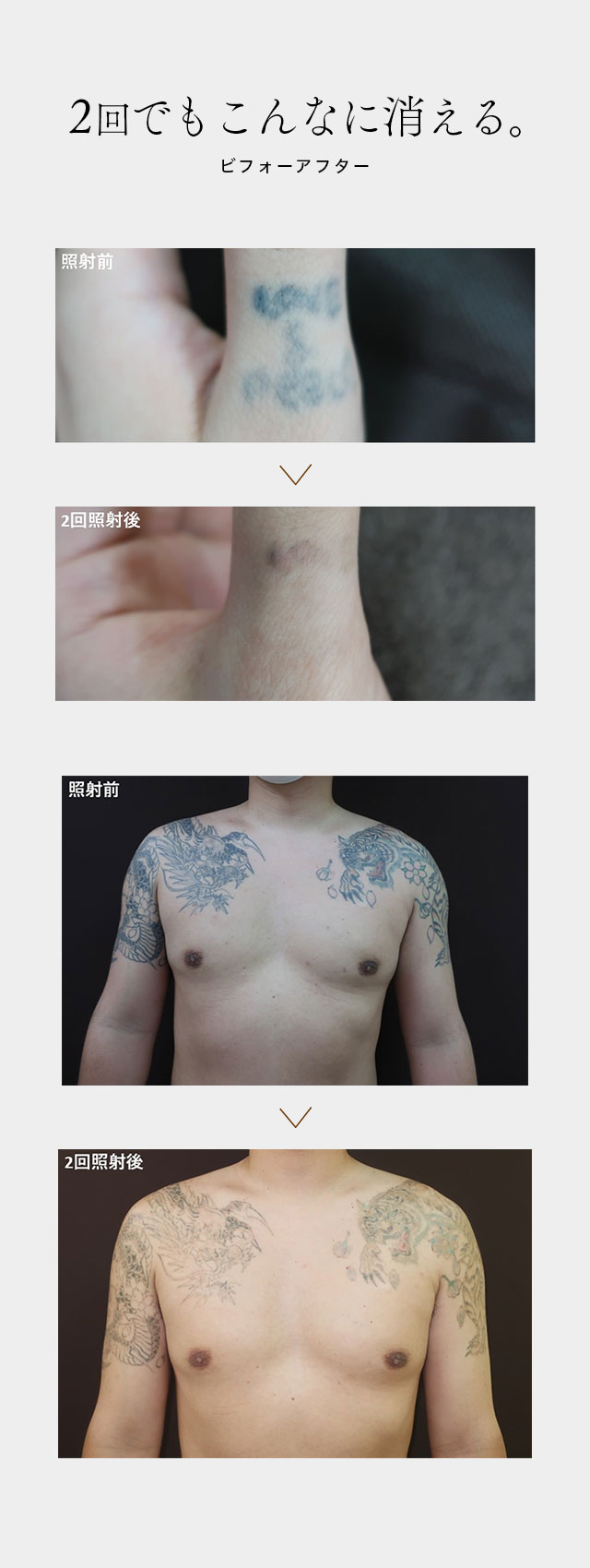 症例紹介 before after