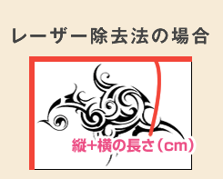 レーザー除去法の場合