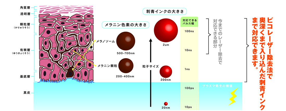 ピコレーザー除去法で奥深くまで入り込んだ刺青インクまで対応できます。
