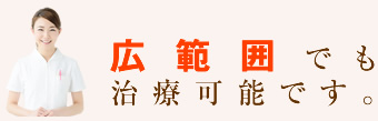 広範囲でも問題ありません