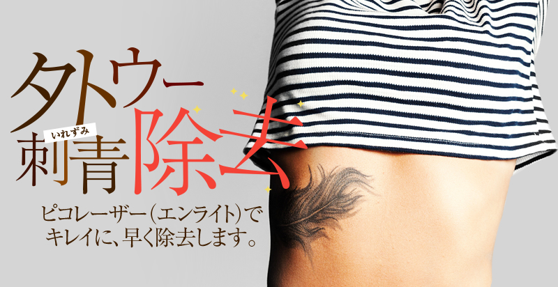 タトゥー刺青除去